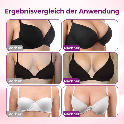 Turonu® Nano-Mikronadel-Pflaster für eine gezielte Brustpflege und ein verbessertes Hautgefühl 🍁