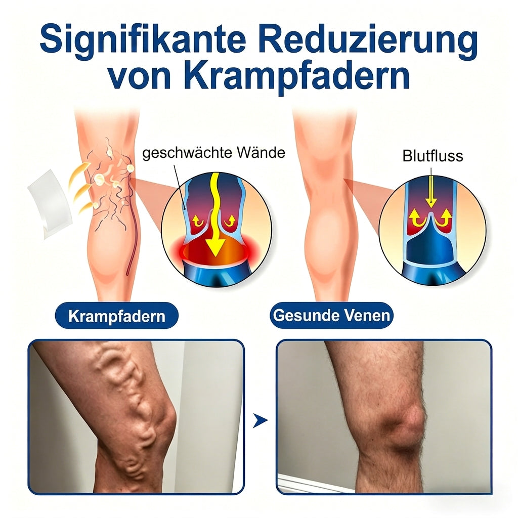 Offizieller Markenstore✅🎉𝑭𝒍𝐨𝐫𝒊𝘀𝒎𝙖® 𝑽𝒆𝒊𝒏𝑻𝒂𝒓𝒈𝒆𝒕 𝑴𝒊𝒌𝒓𝒐𝒏𝒂𝒅𝒆𝒍-𝑷𝒇𝒍𝒂𝒔𝒕𝒆𝒓 ⚡ Sofortige Linderung, langfristige Wirkung