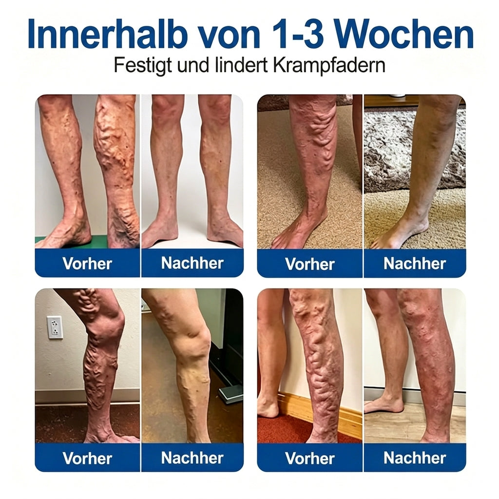 Offizieller Markenstore✅🎉𝑭𝒍𝐨𝐫𝒊𝘀𝒎𝙖® 𝑽𝒆𝒊𝒏𝑻𝒂𝒓𝒈𝒆𝒕 𝑴𝒊𝒌𝒓𝒐𝒏𝒂𝒅𝒆𝒍-𝑷𝒇𝒍𝒂𝒔𝒕𝒆𝒓 ⚡ Sofortige Linderung, langfristige Wirkung