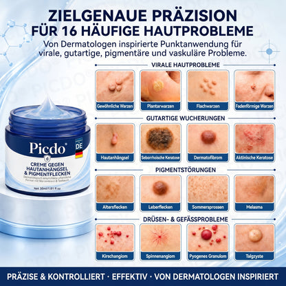 𝐏𝐢𝐜𝐝𝐨® 𝟕-𝐓𝐚𝐠𝐞 𝐇𝐚𝐮𝐭𝐚𝐧𝐡ä𝐧𝐠𝐬𝐞𝐥- & 𝐅𝐥𝐞𝐜𝐤𝐞𝐧-𝐄𝐧𝐭𝐟𝐞𝐫𝐧𝐮𝐧𝐠𝐬𝐜𝐫𝐞𝐦𝐞 (𝐒𝐜𝐡𝐦𝐞𝐫𝐳𝐟𝐫𝐞𝐢𝐞 𝐅𝐨𝐫𝐦𝐞𝐥 – 𝐨𝐡𝐧𝐞 𝐍𝐚𝐫𝐛𝐞𝐧) 🌹