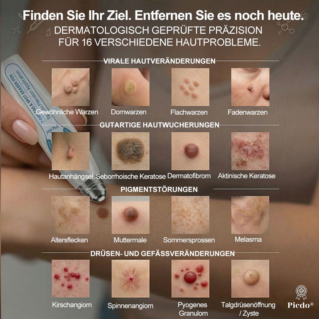Offizieller Markenstore |✅𝑷𝑖𝒄𝐝𝐨® 7-𝑻𝒂𝒈𝒆 𝑯𝒂𝒖𝒕𝒂𝒏𝒉ä𝒏𝒈𝒔𝒆𝒍- & 𝑭𝒍𝒆𝒄𝒌𝒆𝒏𝒆𝒏𝒕𝒇𝒆𝒓𝒏𝒆𝒓(Schmerzfreier Rollerball – Keine Narbenbildung)🎉